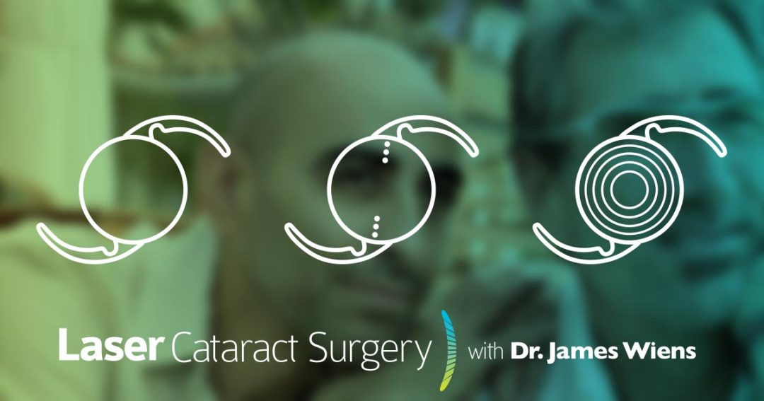 OGImageLaserCataractLensOptions Winnipeg Laser Cataract Surgery